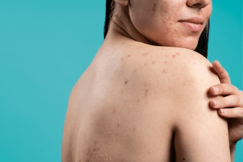 dermatologia 5 datos que no sabías sobre el cuidado de tu piel