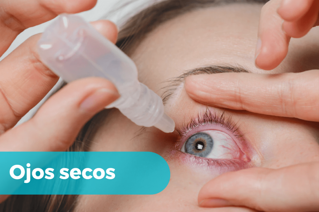 Ojo Seco Causas Síntomas Y Tratamiento Doctorisy 9514